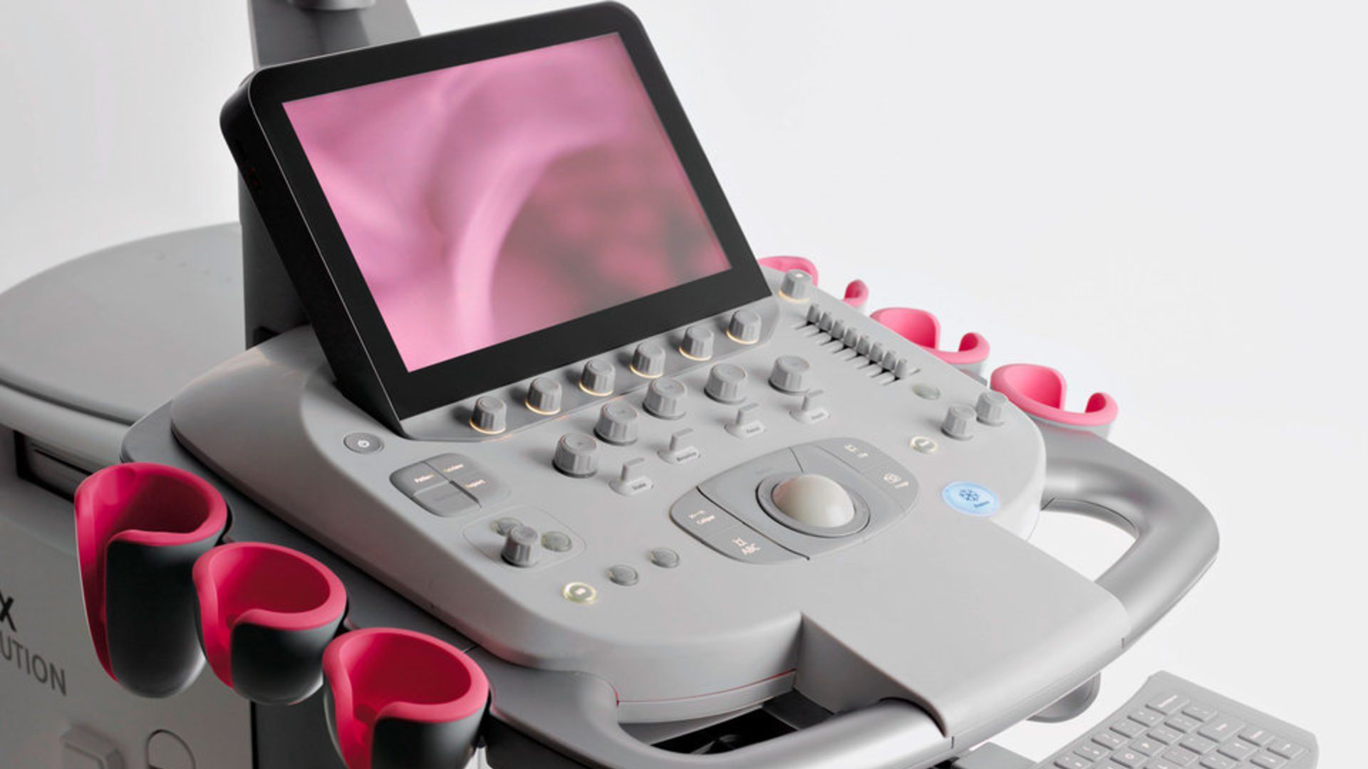 acuson_s1000_ultrasound_system_helx_evolution_with_touch_control-02422913_10-06551667_8